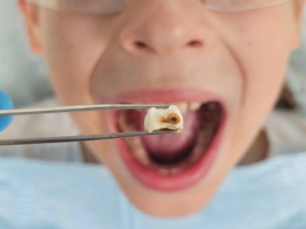 Best Emergency Treatment for Toothache in Wakeman, OH